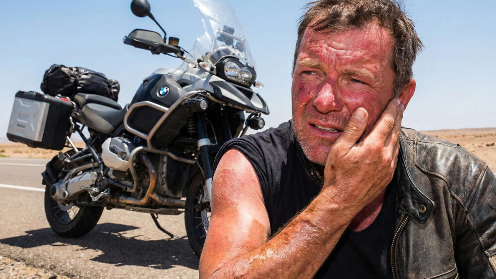 สาเหตุผิวคล้ำ แสบ แดงจากการขี่บิ๊กไบค์และการสัมผัสแดดลม